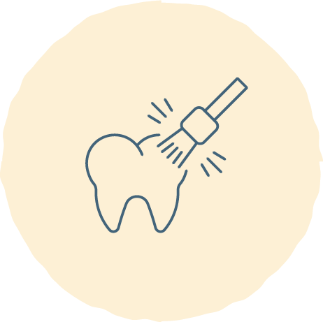 予防・クリーニング